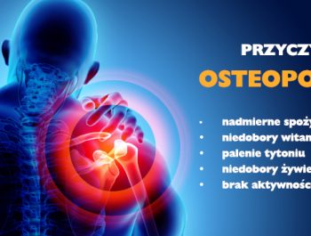 osteroporoza 16 marca 2023