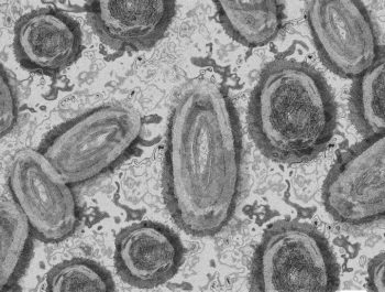 monkey-pox-g52d15189f_1920-1170×780